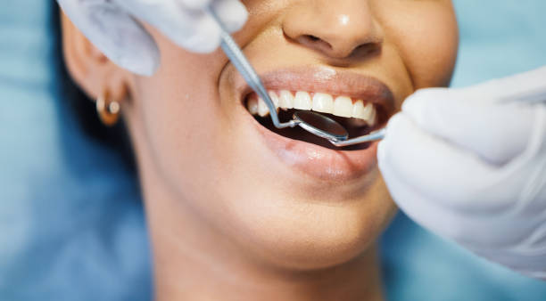 Best Knocked-Out Tooth Emergency  in Abbeville, LA